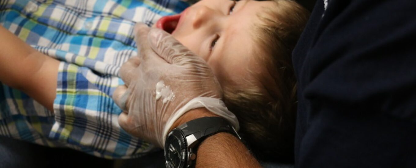 A boy's head is in the lap of a provider who is doing the knee-to-knee exam and painting fluoride varnish on his teeth